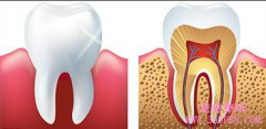 如何判断牙髓是否坏死？