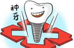 韩国种植牙品牌排行榜名称？哪些韩国种植牙品牌比较好？